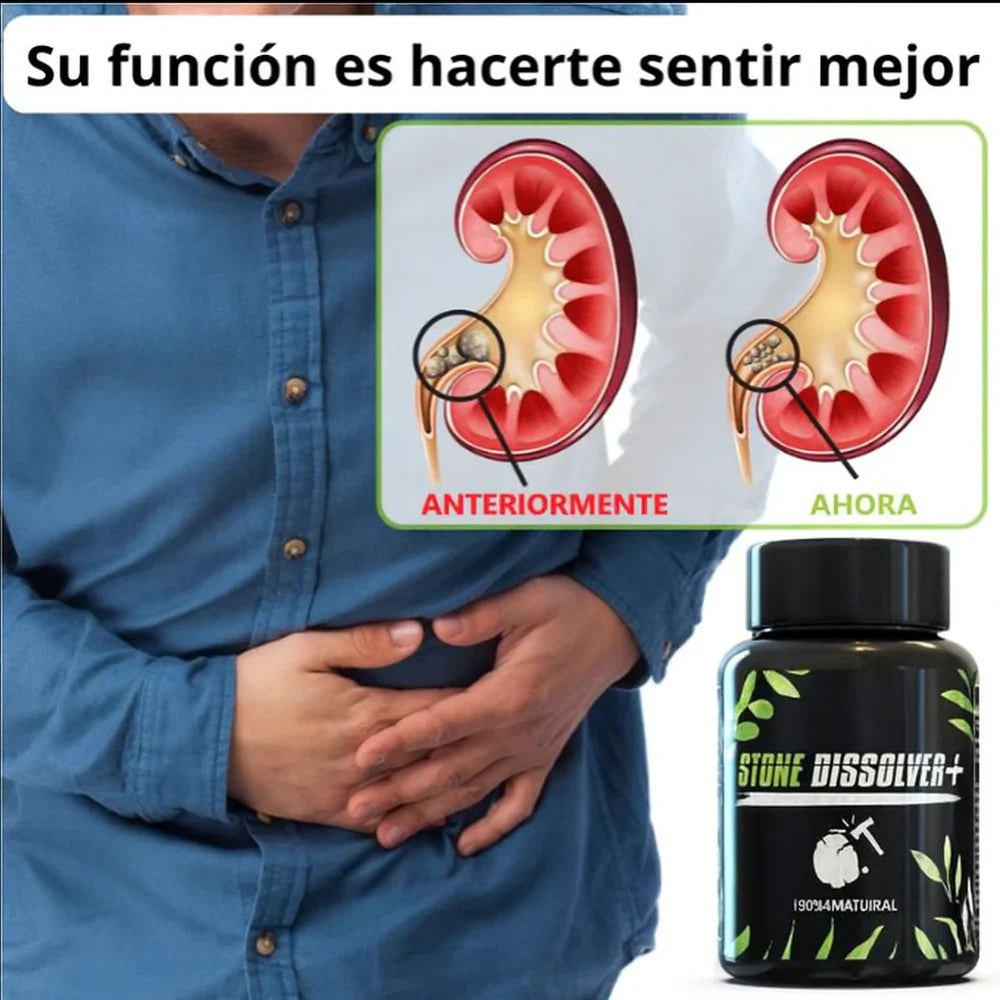 STONE DISSOLVER Suplemento Renal 100% Natural + ENVIO GRATIS